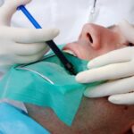 Explaining Dental Root Planning: A General Dentist’s Perspective