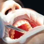 Cosmetic Dental Surgery: What To Expect